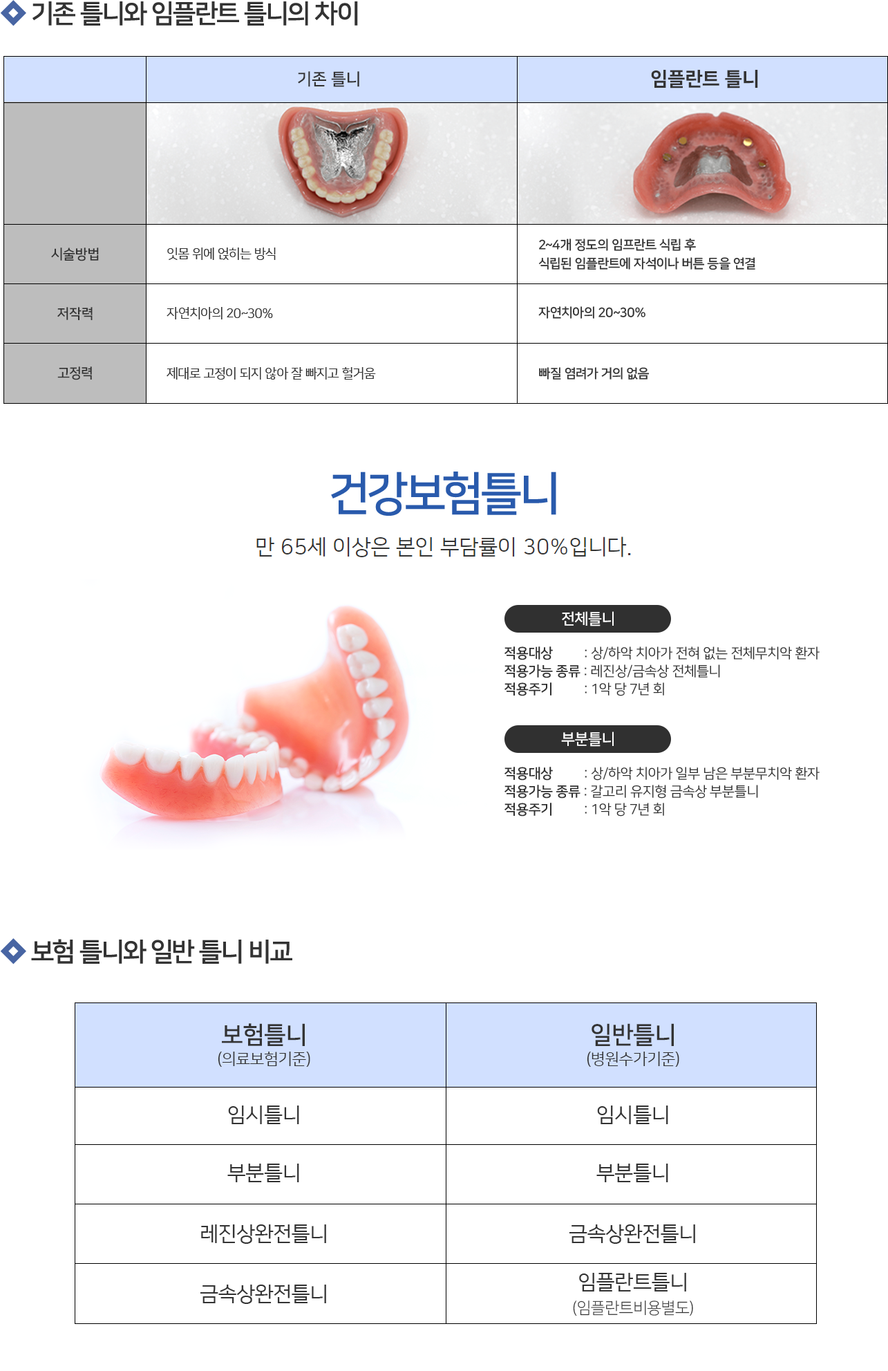 기존 틀니와 임플란트 틀니의 차이