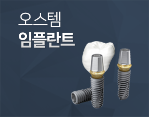 애프터플란트 임플란트