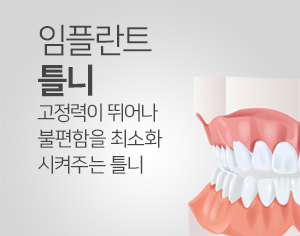 임플란트 틀니