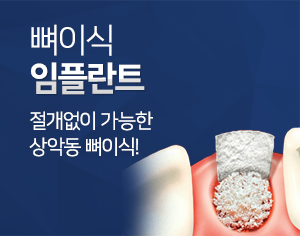 뼈이식 임플란트