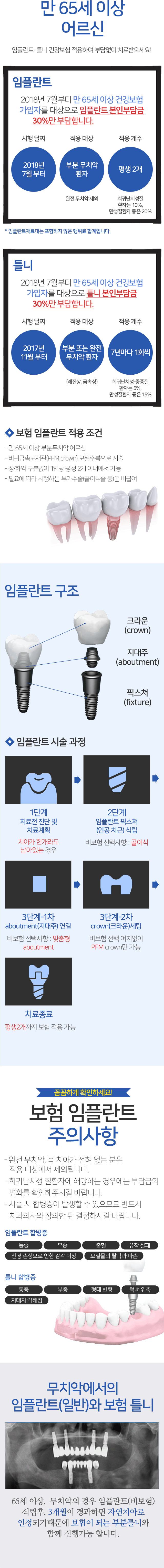 보험 임플란트 적용 조건