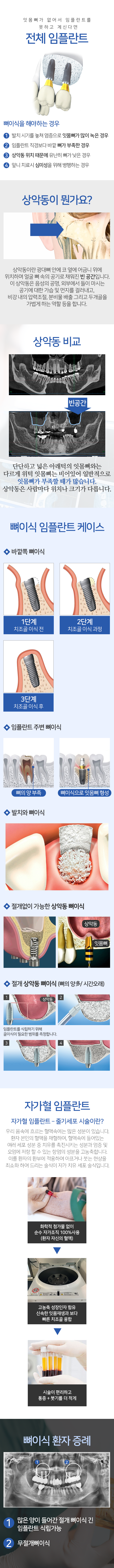 뼈 이식 임플란트