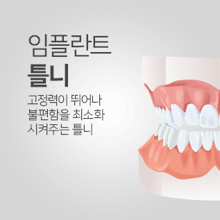임플란트 틀니