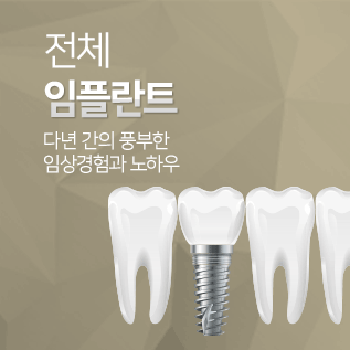 전체 임플란트