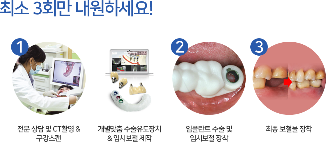 무치악의 치료방법