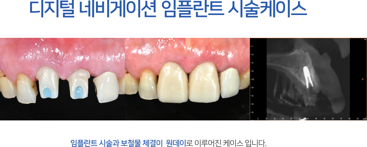 무치악의 문제점