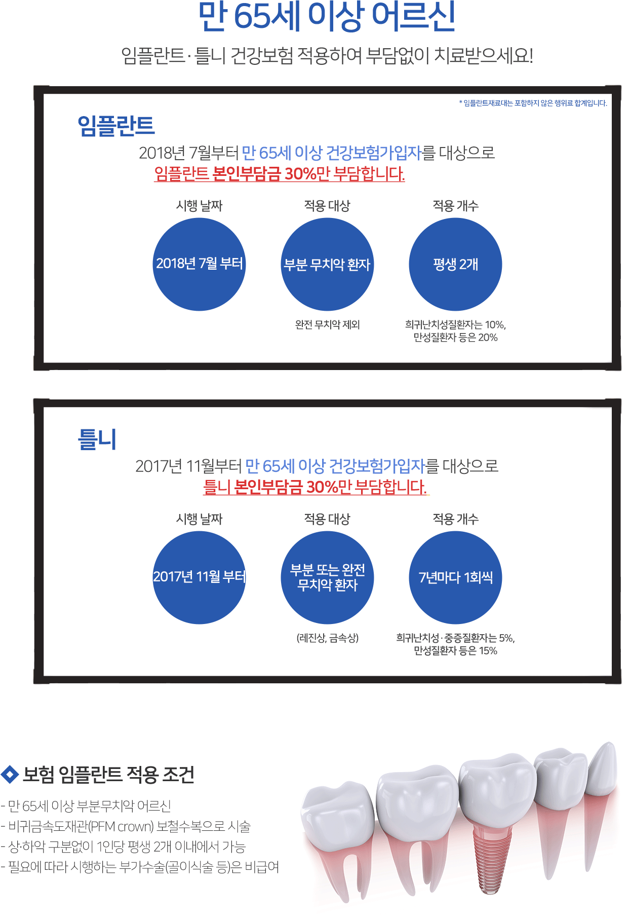 보험 임플란트 적용 조건
