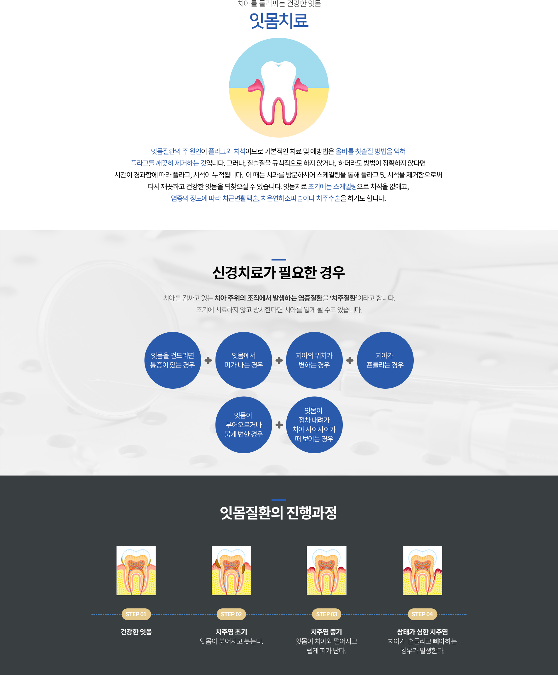 잇몸치료의 진행과정