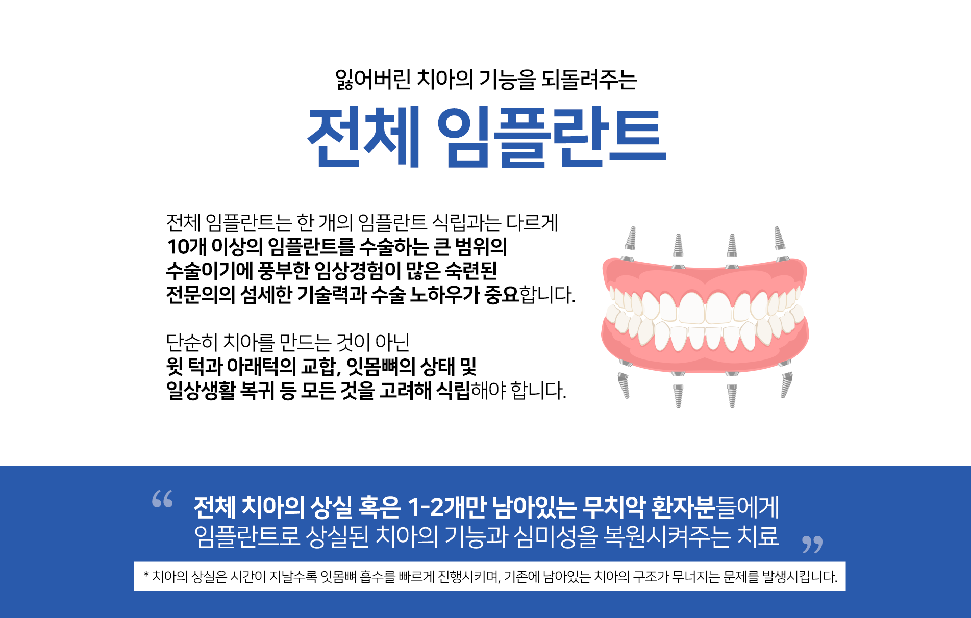 전체 임플란드 PC1