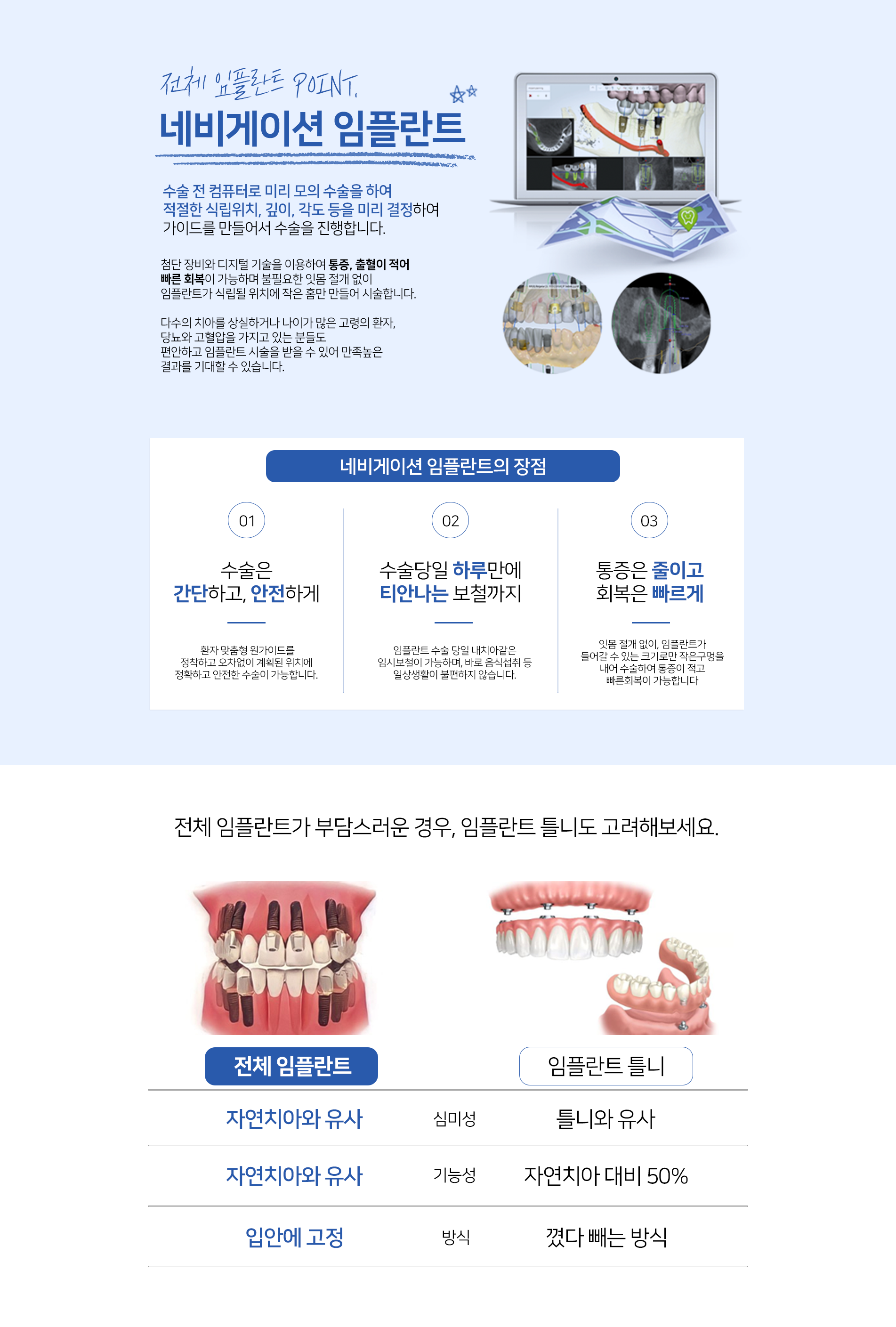 전체 임플란드 PC4
